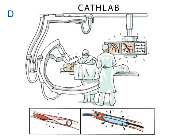 Cath Lab Picture – Cardiovascular Interventions Orlando