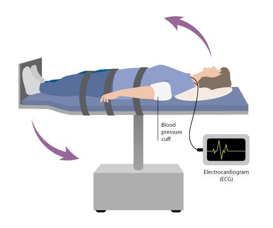 Tilt Test - Cardio Web - CNAP