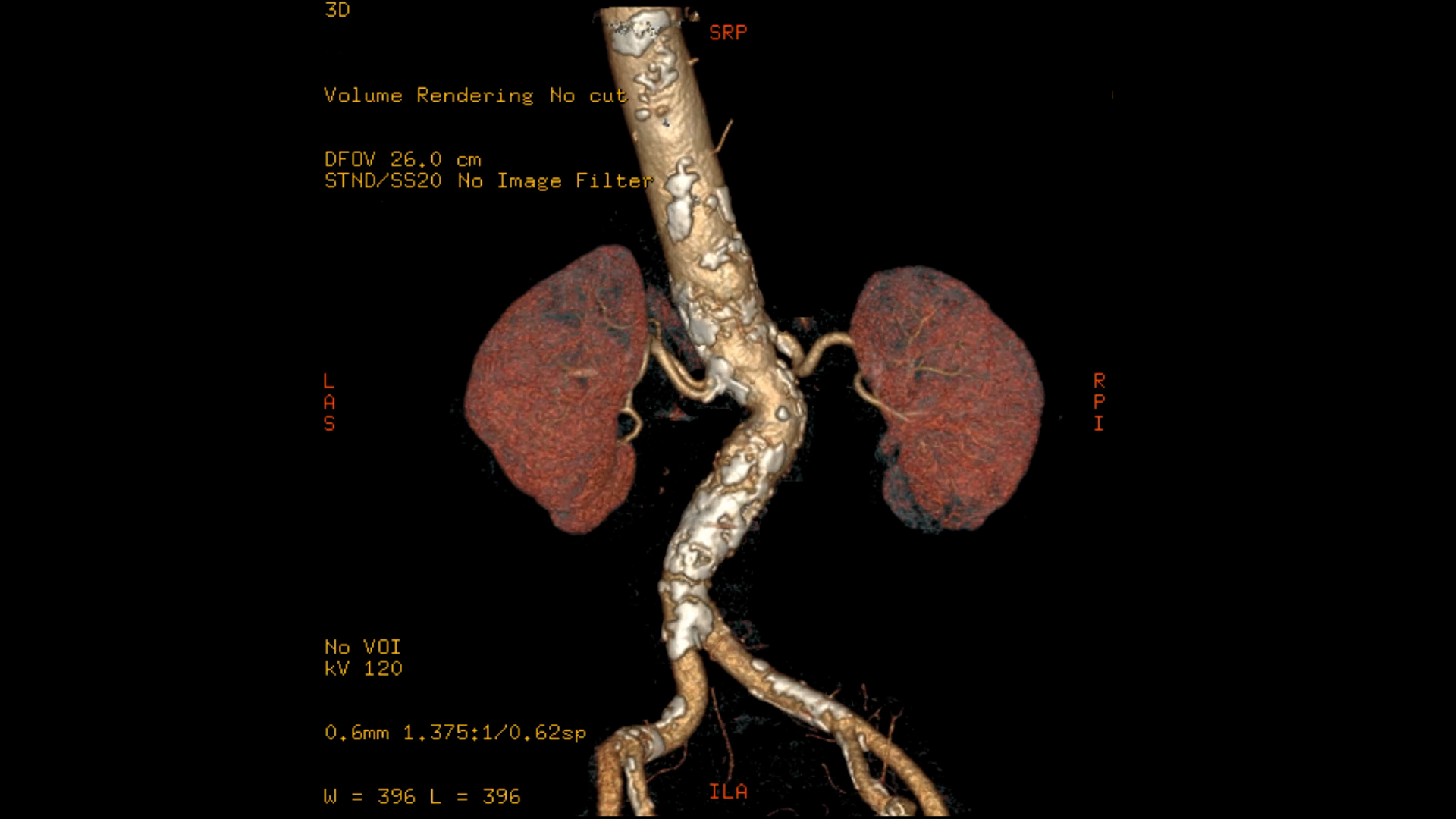 Home - Cardiovascular Interventions Orlando