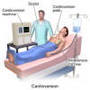 Ventricular Fibrillation - Cardiovascular Interventions Orlando